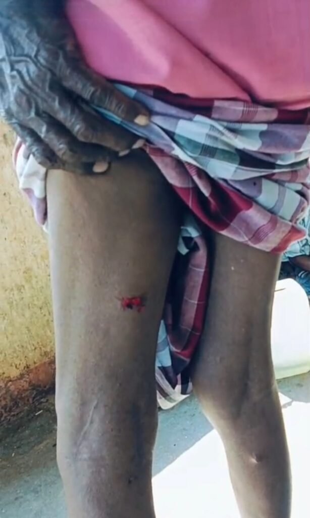 ‘గణపురం’లో కుక్కల స్వైరవిహారం..