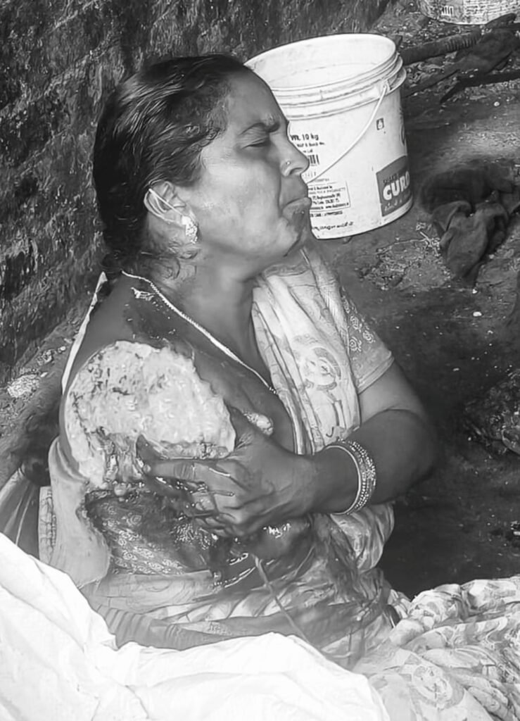 నూనె మిల్లులో ప్రమాదం.. భుజం వరకు ఊడిపోయిన మహిళా కుడి చెయ్యి